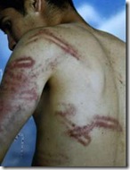 torture3
